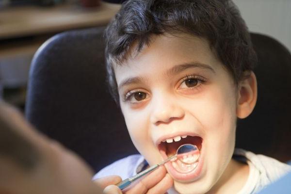 boy showing tooth